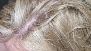 A super beautiful FFS model with an amazing body